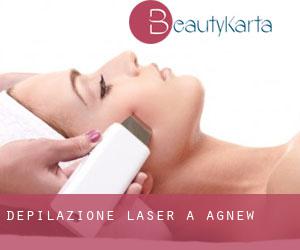 Depilazione laser a Agnew