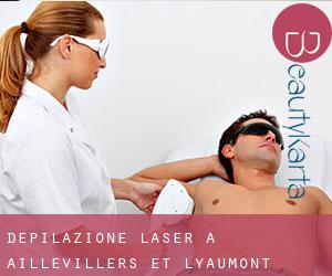 Depilazione laser a Aillevillers-et-Lyaumont