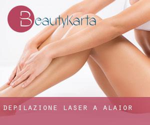 Depilazione laser a Alaior