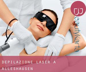 Depilazione laser a Alleshausen