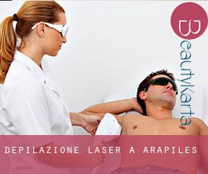 Depilazione laser a Arapiles