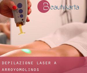 Depilazione laser a Arroyomolinos
