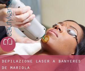 Depilazione laser a Banyeres de Mariola