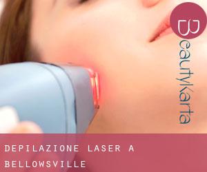 Depilazione laser a Bellowsville