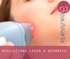 Depilazione laser a Bernbach