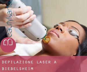 Depilazione laser a Biebelsheim