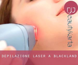 Depilazione laser a Blackland