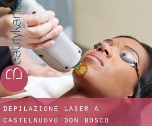 Depilazione laser a Castelnuovo Don Bosco