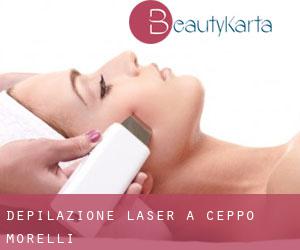Depilazione laser a Ceppo Morelli