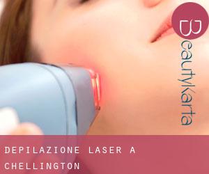Depilazione laser a Chellington