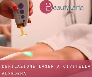 Depilazione laser a Civitella Alfedena