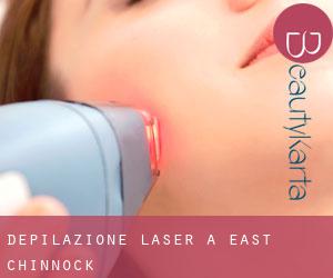 Depilazione laser a East Chinnock