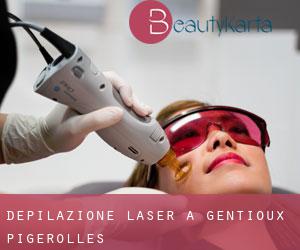 Depilazione laser a Gentioux-Pigerolles