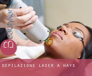 Depilazione laser a Hays