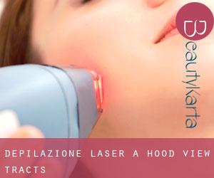 Depilazione laser a Hood View Tracts