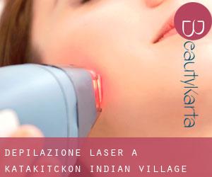 Depilazione laser a Katakitckon Indian Village