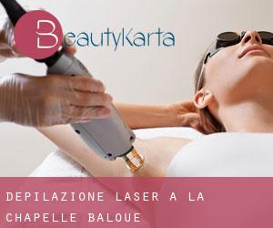 Depilazione laser a La Chapelle-Baloue