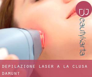 Depilazione laser a la Clusa d'Amunt