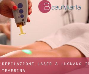 Depilazione laser a Lugnano in Teverina