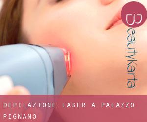 Depilazione laser a Palazzo Pignano