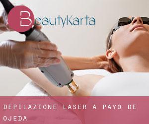 Depilazione laser a Payo de Ojeda