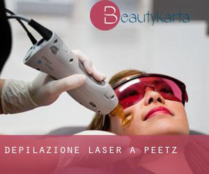 Depilazione laser a Peetz