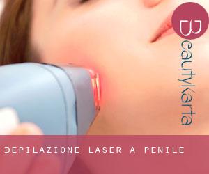 Depilazione laser a Penile