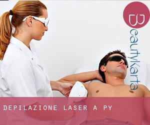 Depilazione laser a Py