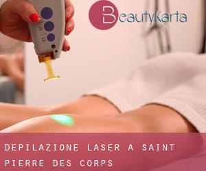 Depilazione laser a Saint-Pierre-des-Corps