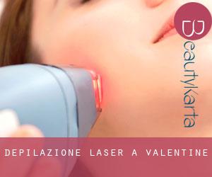 Depilazione laser a Valentine