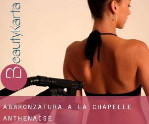 Abbronzatura a La Chapelle-Anthenaise