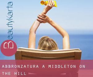Abbronzatura a Middleton on the Hill