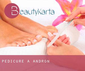 Pedicure a Andron