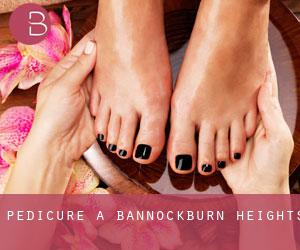 Pedicure a Bannockburn Heights