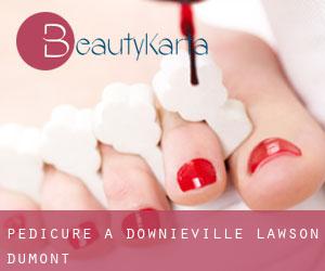 Pedicure a Downieville-Lawson-Dumont