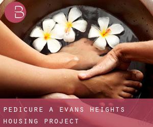 Pedicure a Evans Heights Housing Project